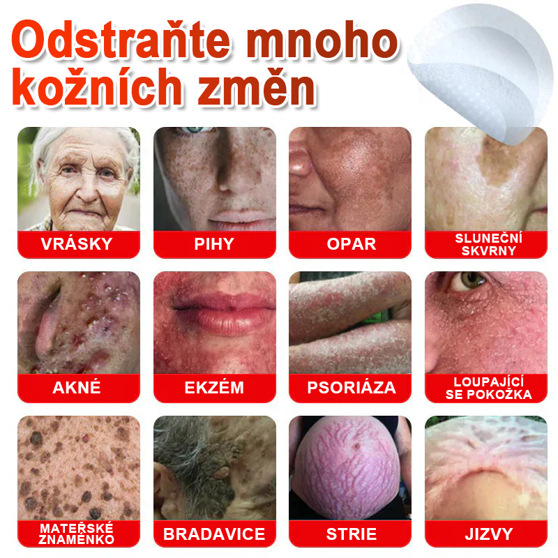 TLOPA® Mikrovpichová botanická náplast na odstranění kožních výrůstků 🇨🇿 Vyrobeno v Česká republika🇨🇿🇨🇿