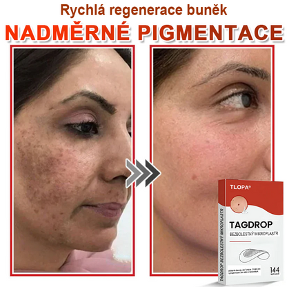 TLOPA® Mikrovpichová botanická náplast na odstranění kožních výrůstků 🇨🇿 Vyrobeno v Česká republika🇨🇿🇨🇿