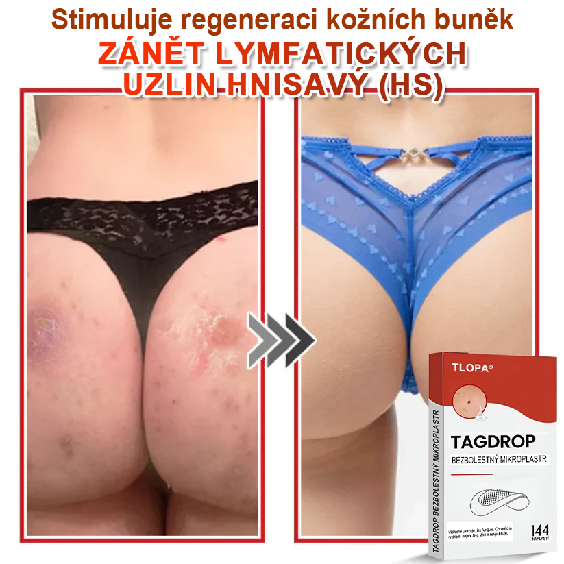 TLOPA® Mikrovpichová botanická náplast na odstranění kožních výrůstků 🇨🇿 Vyrobeno v Česká republika🇨🇿🇨🇿