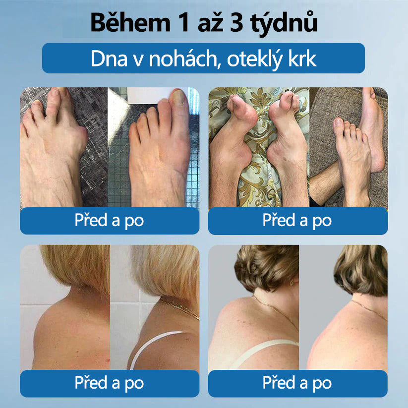 Lékárna Na Poště | Foulme® BPC-157 Regenerační krém na klouby 🦴💥💥 Léčí artritidu, neuropatii, revmatismus, sportovní zranění a další potíže 👍👍
