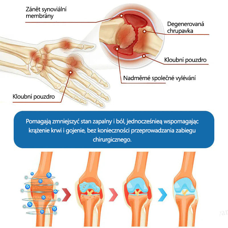Lékárna Na Poště | Foulme® BPC-157 Regenerační krém na klouby 🦴💥💥 Léčí artritidu, neuropatii, revmatismus, sportovní zranění a další potíže 👍👍