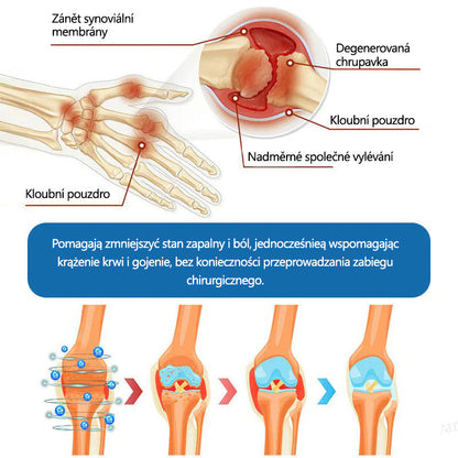 Lékárna Na Poště | Foulme® BPC-157 Regenerační krém na klouby 🦴💥💥 Léčí artritidu, neuropatii, revmatismus, sportovní zranění a další potíže 👍👍