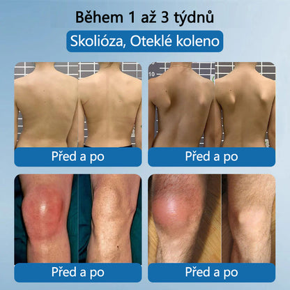 Lékárna Na Poště | Foulme® BPC-157 Regenerační krém na klouby 🦴💥💥 Léčí artritidu, neuropatii, revmatismus, sportovní zranění a další potíže 👍👍