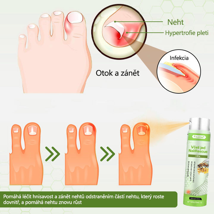 Lékárna Na Dr. Max Oficiální obchod | Foulme® NailRescue Včelí jed ve spreji🐝