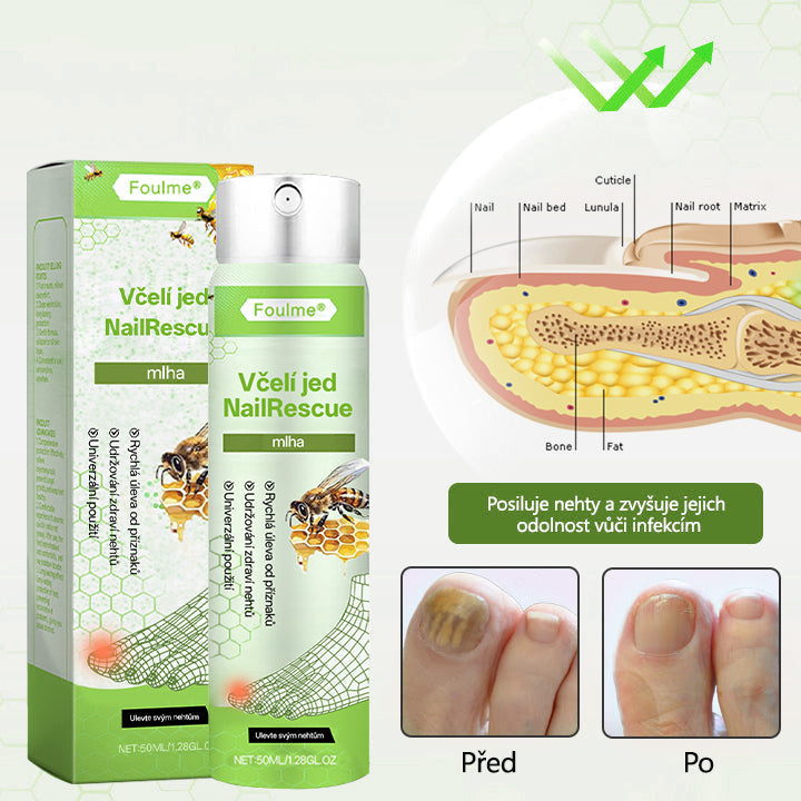 Lékárna Na Dr. Max Oficiální obchod | Foulme® NailRescue Včelí jed ve spreji🐝