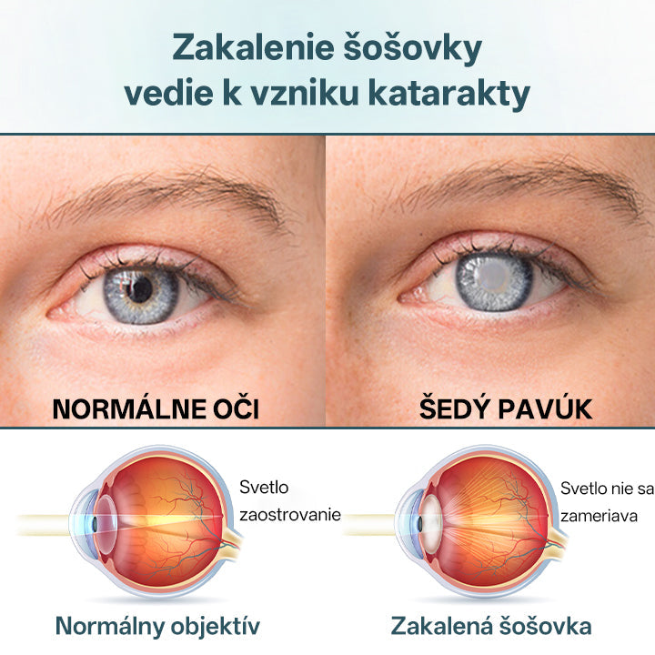 💧👁️Očné kvapky Timilk® OptiFusion Nano sérum！💧💧