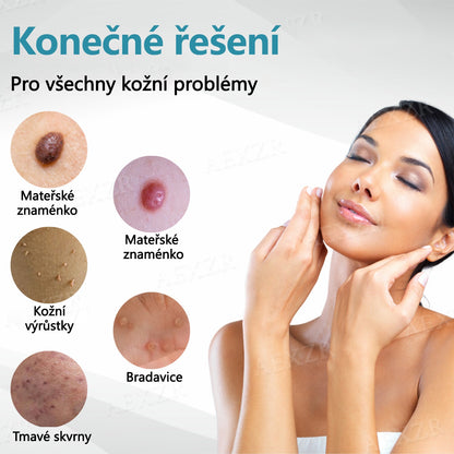 [Oficiální vlajkový obchod]Foulme® PRO Neinvazivní laserové pero na odstraňování bradavic a znamének💥