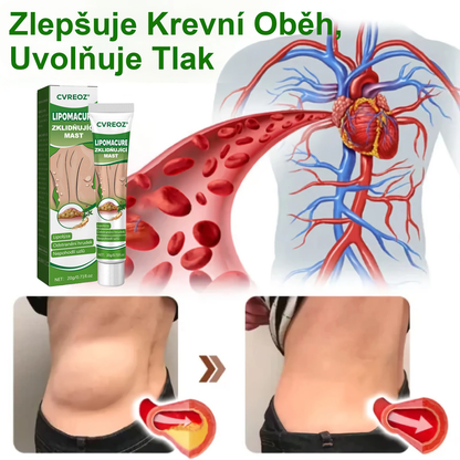 Cvreoz® LipomaCure — Účinná péče o lipomy bez operace