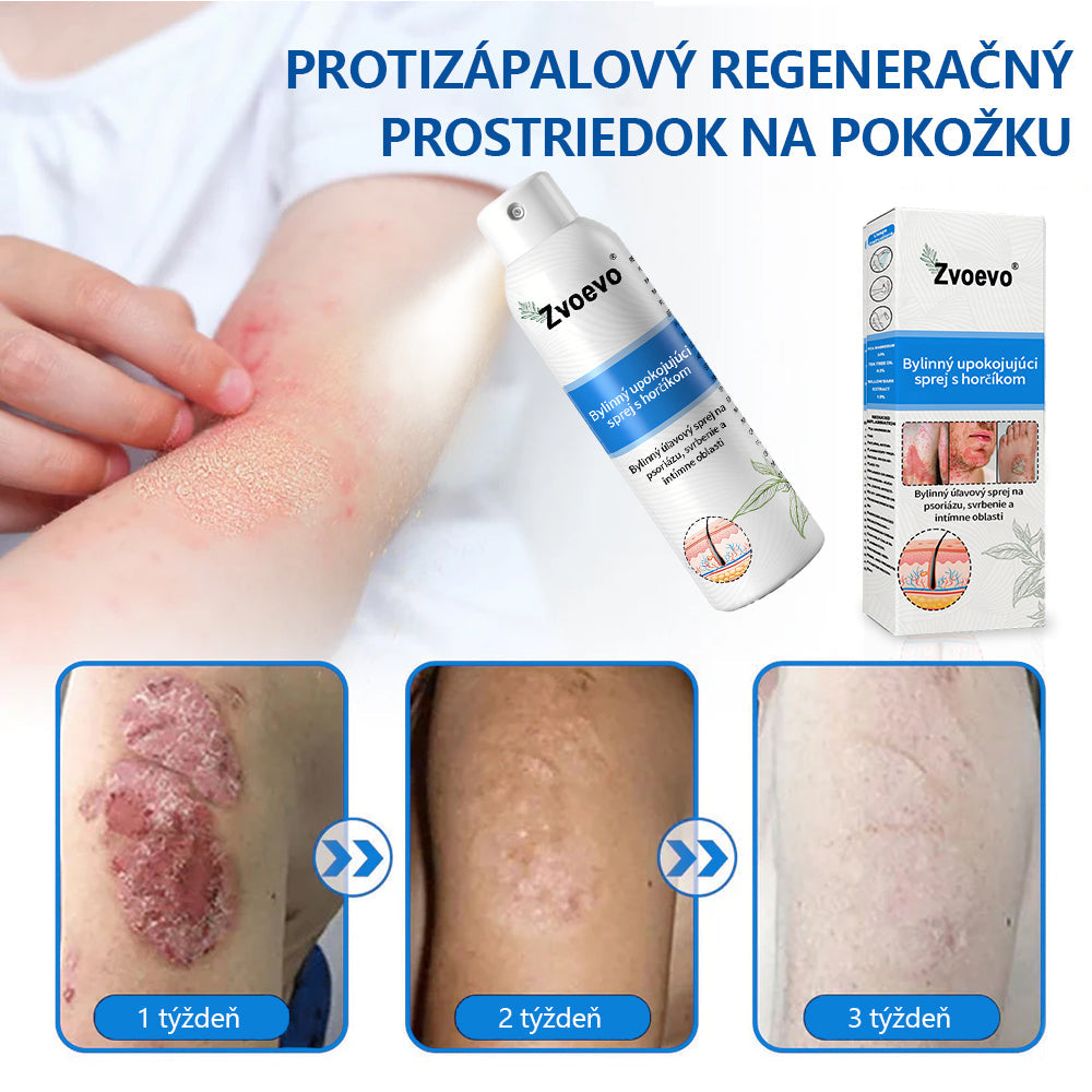 Oficiálny obchod✨: Zvoevo®Horčíkový bylinný sprej na psoriázu⚕️certifikované FDA (úľava od psoriázy a ekzému, zlepšenie bakteriálnych infekcií v oblasti genitálií a liečba akné a tmavých škvŕn)