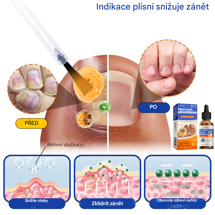 🐝🐝FurzeroTM Řešení pro léčbu nehtové plísně včelím jedem: Kompletní řešení nehtové plísně🌟👣👣
