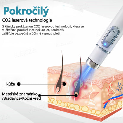 [Oficiální vlajkový obchod]Foulme® PRO Neinvazivní laserové pero na odstraňování bradavic a znamének💥